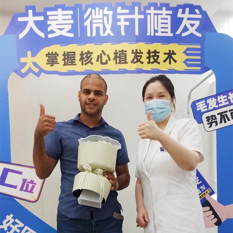 Body hair transplant results