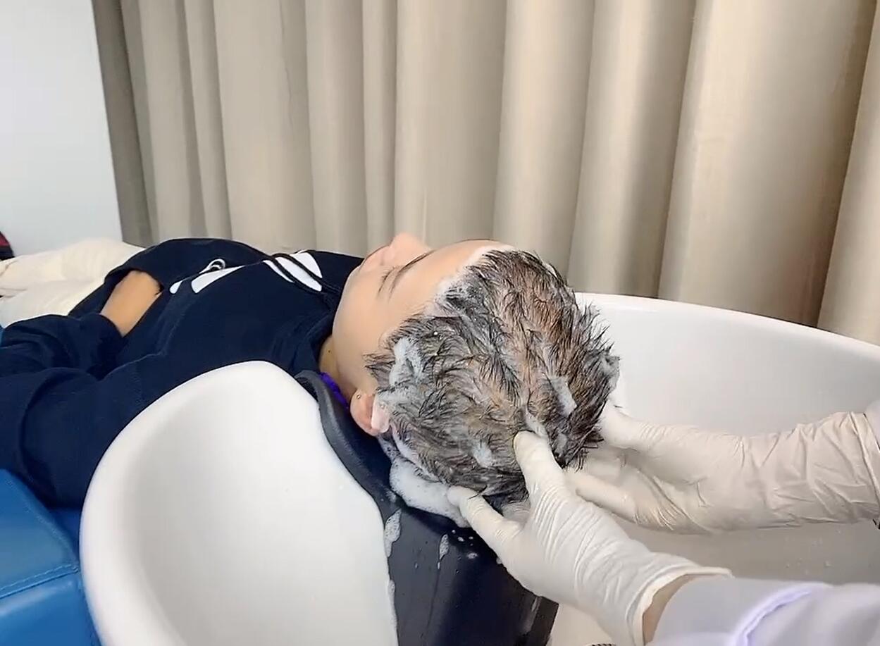 hair wash after hair transplant